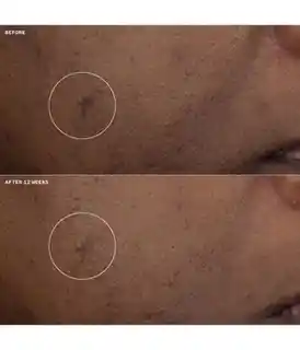 Clinique Even Better Clinical Brightening Moisturizer Krem do twarzy 50ml