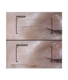 Filorga Time Filler Shot 5XP 15ml