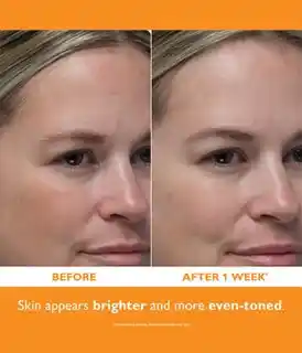 Peter Thomas Roth Potent-C Power Serum do twarzy 30ml