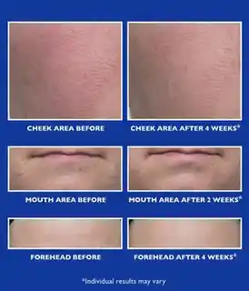 Peter Thomas Roth Retinol Fusion PM Serum na noc 30ml