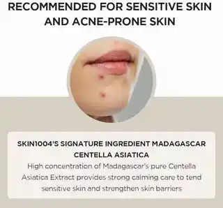 Skin1004 Madagascar Centella Ampoule serum do twarzy 100 ml, odżywcze, kojące, z wąkrotą azjatycką