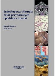 ENDOSKOPOWA CHIRURGIA ZATOK PRZYNOSOWYCH I PODSTAWY CZASZKI 2018