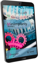 Miniimplanty (e-book) [pdf]