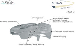 Aparat RMO Multi-S - Elastyczny aparat ortodontyczny -