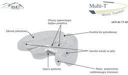 Aparat RMO Multi-T - Elastyczny aparat ortodontyczny -