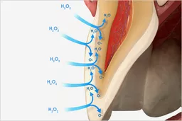 Grafika przedstawiająca jak nadtlenek wodoru wnika w głąb zęba wybielając go od środka